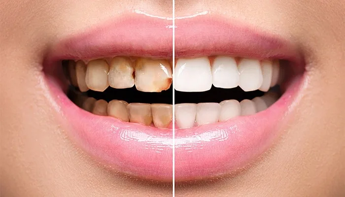 Clínica Dental Smile - Foto 2 | Guía Margarita