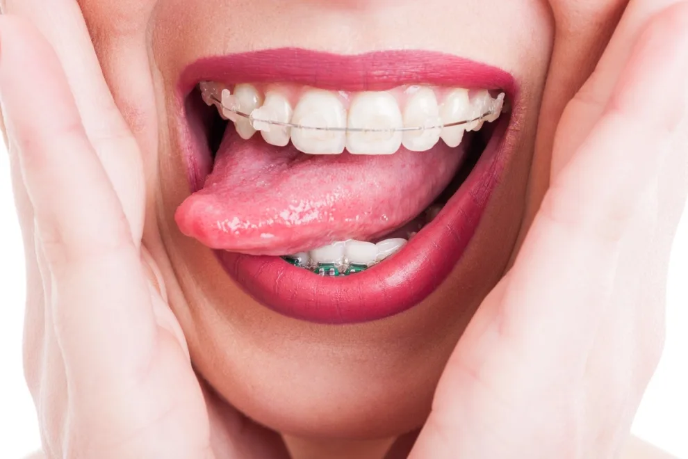 Clínica Dental Smile - Foto 3 | Guía Margarita