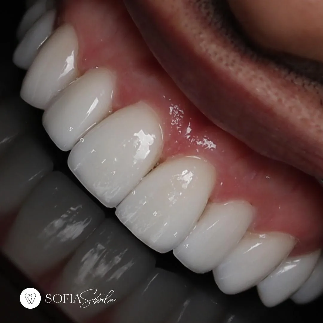 Clínica Dental Sofia Sibila - Foto 2 | Guía Margarita