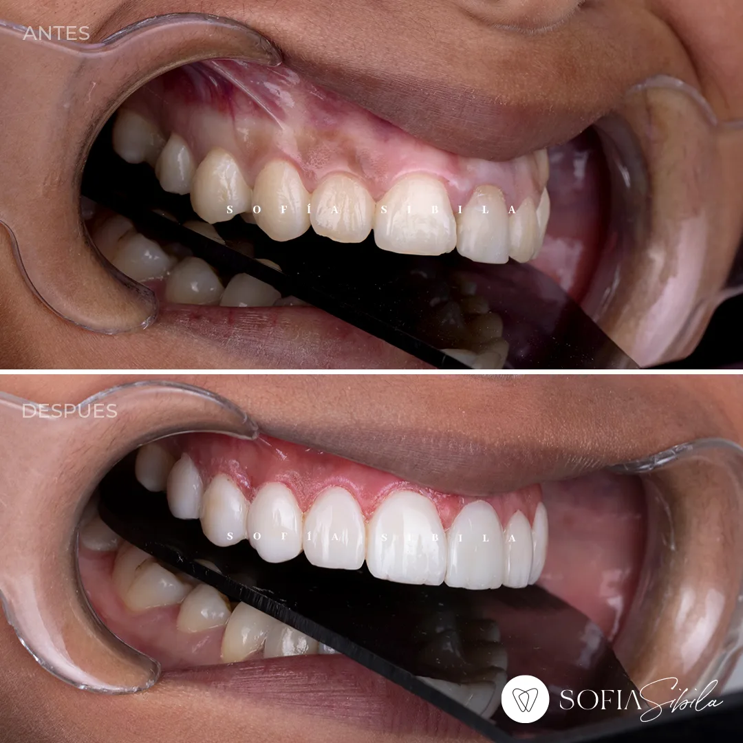 Clínica Dental Sofia Sibila - Foto 3 | Guía Margarita