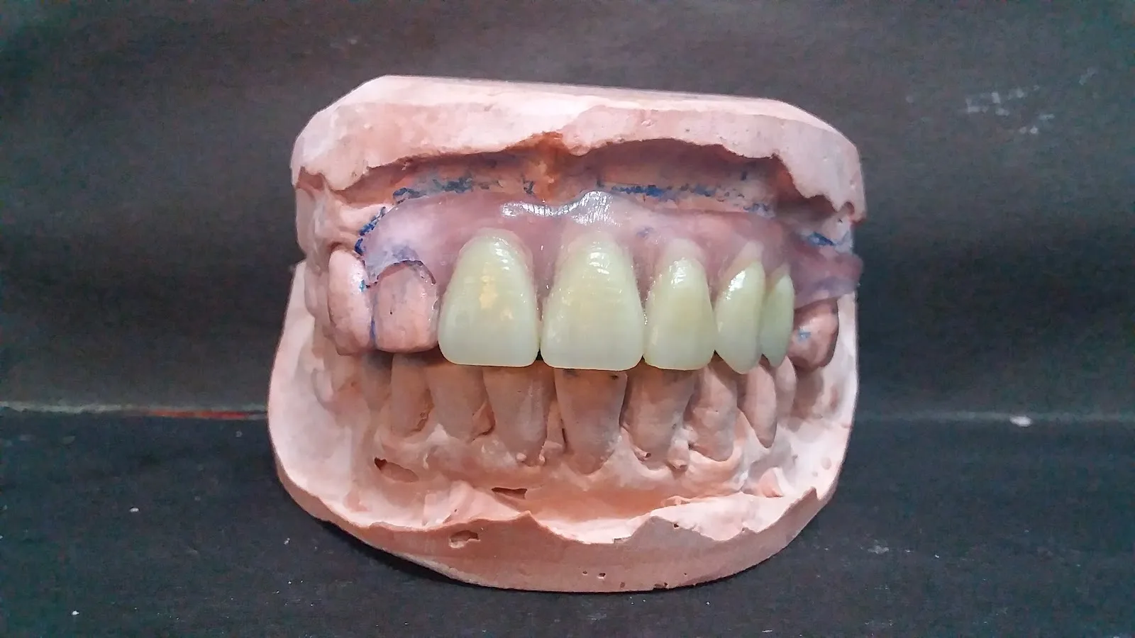 Clínica Odontológica y Laboratorio Dental Majf-dent - Foto 2 | Guía Margarita