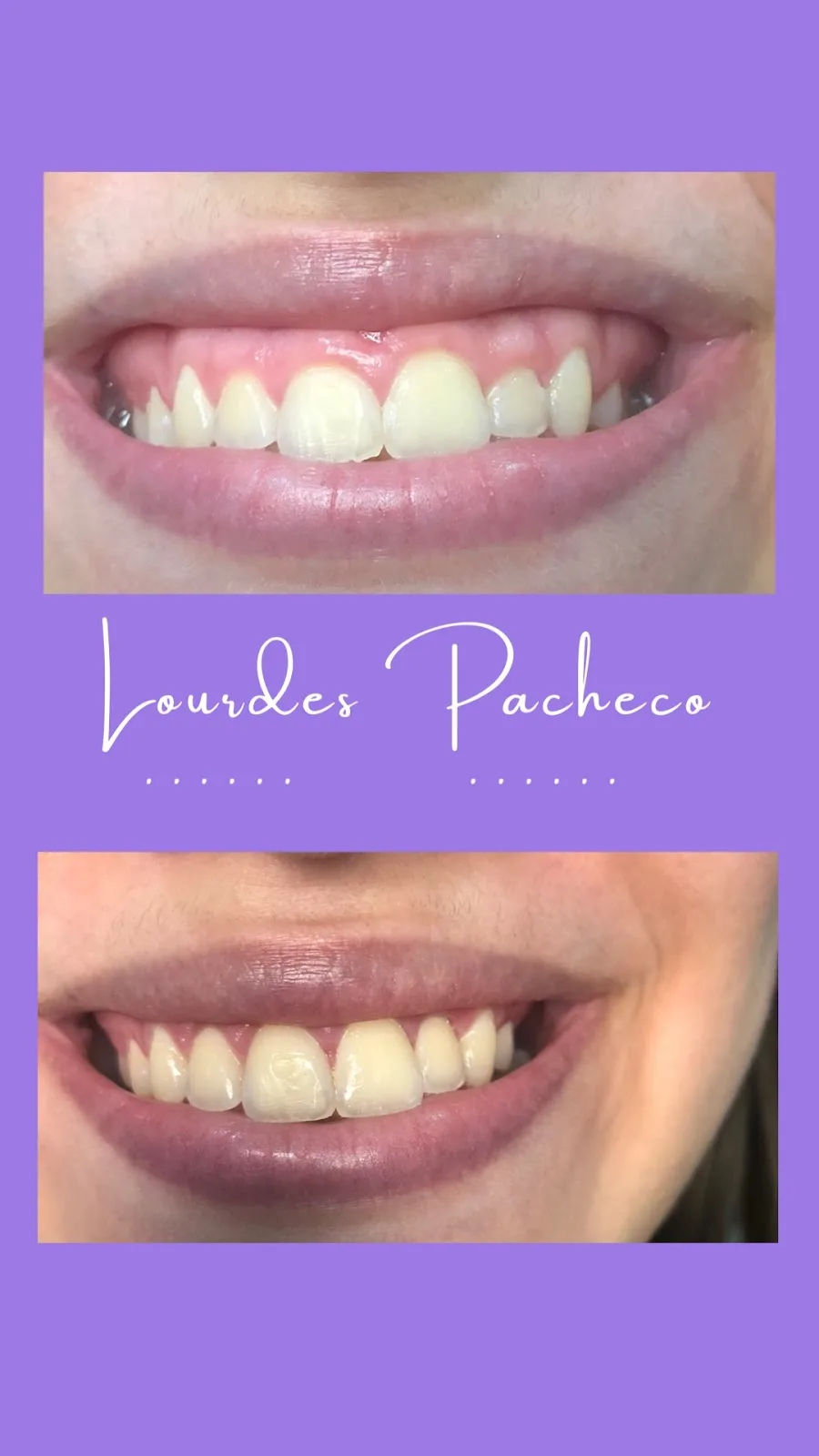 Integra Dental Dra. Lourdes Pacheco