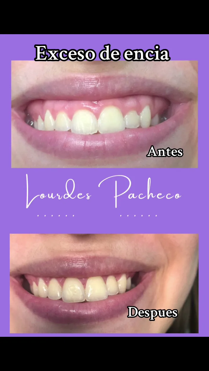Integra Dental Dra. Lourdes Pacheco - Foto 2 | Guía Margarita