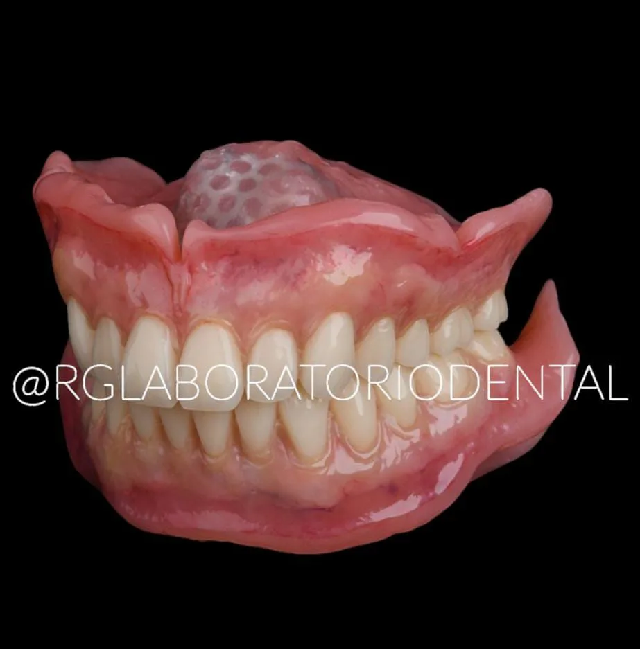 RG Laboratorio Dental