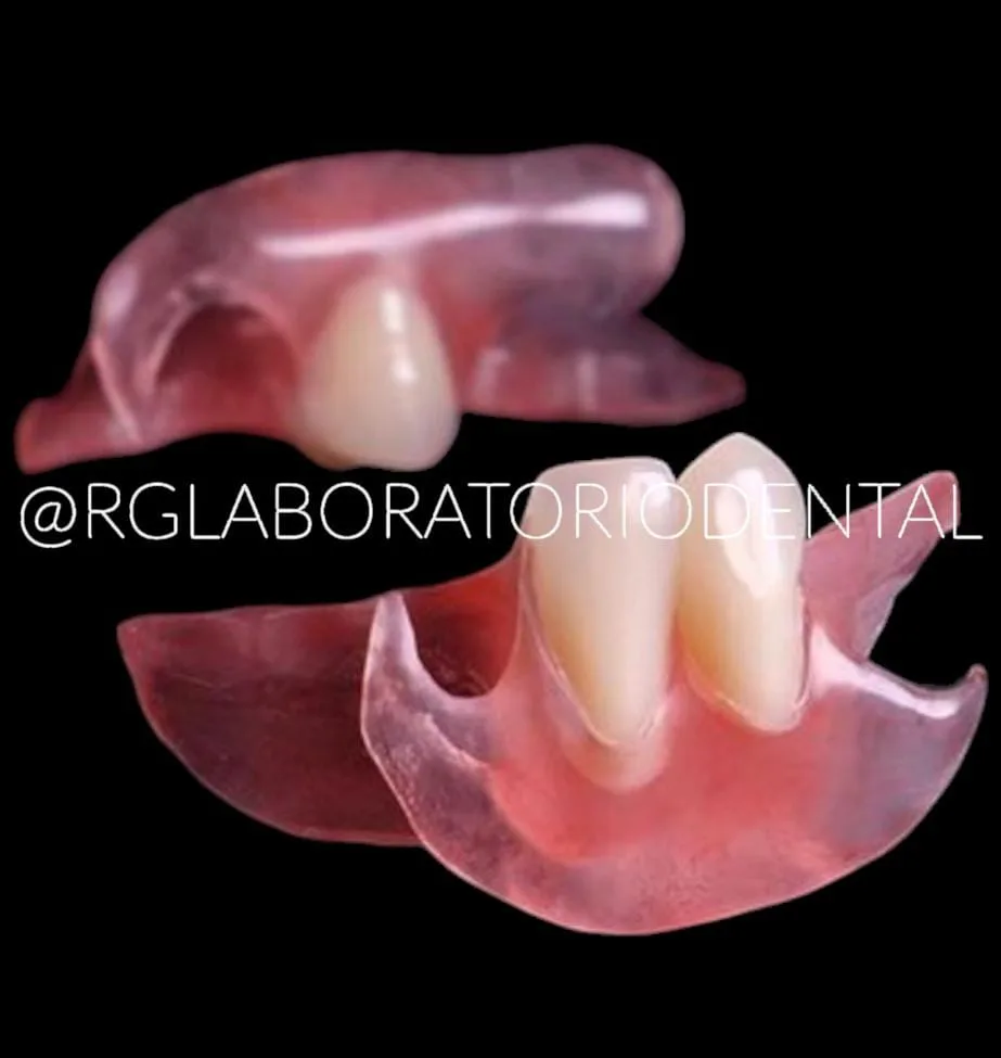 RG Laboratorio Dental - Foto 3 | Guía Margarita